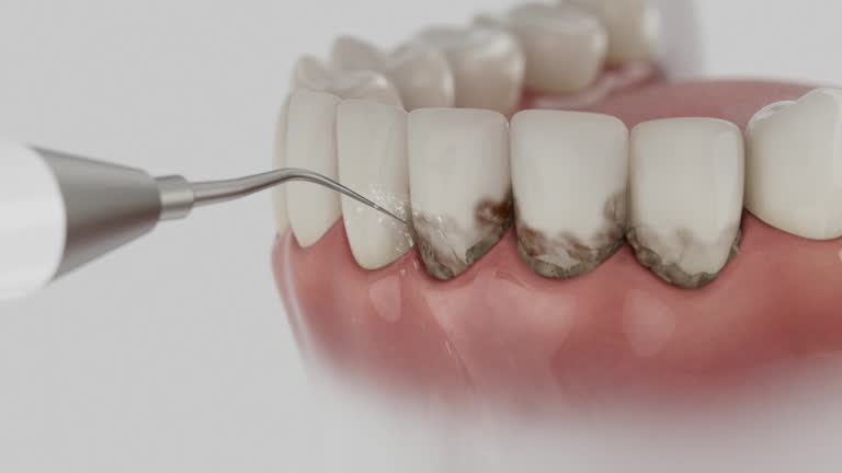Trusted Root Canal Treatment service in Bellevue, MI - Dentist Open Now